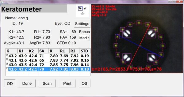 Screenshot of the MMD PalmScan K2000 Pro Auto Keratometer software featuring measurements for the right eye (od), including keratometry and astigmatism values, with a highlighted corneal