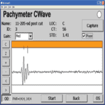 Screenshot of a MMD PALMSCAN PACHYMETER OPTIONAL DSAEK PACKAGE software showing a DSAEK c-wave graph with various control settings and patient id details.